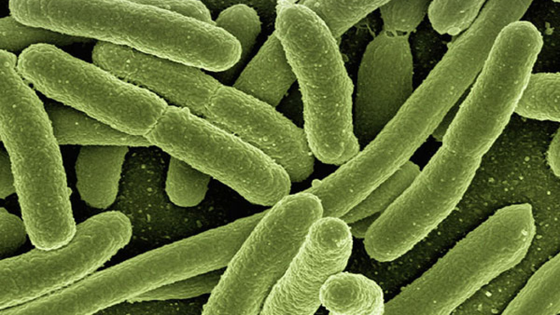 a microscopic view of E. coli bacteria