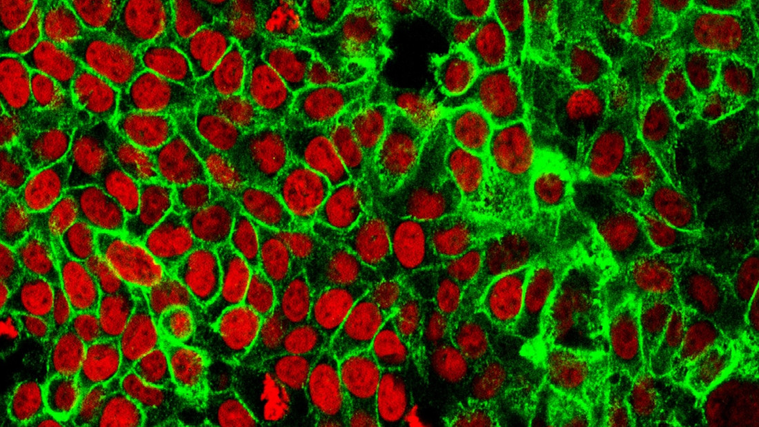 Colon cancer cells