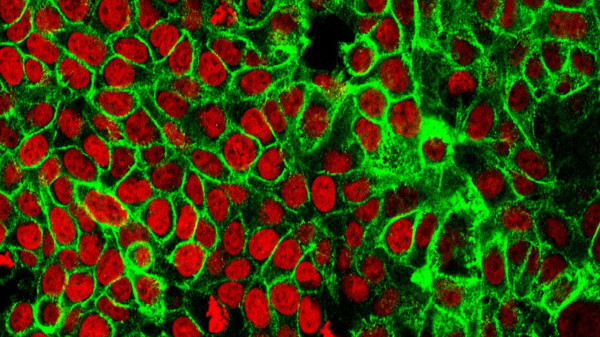 Colon cancer cells