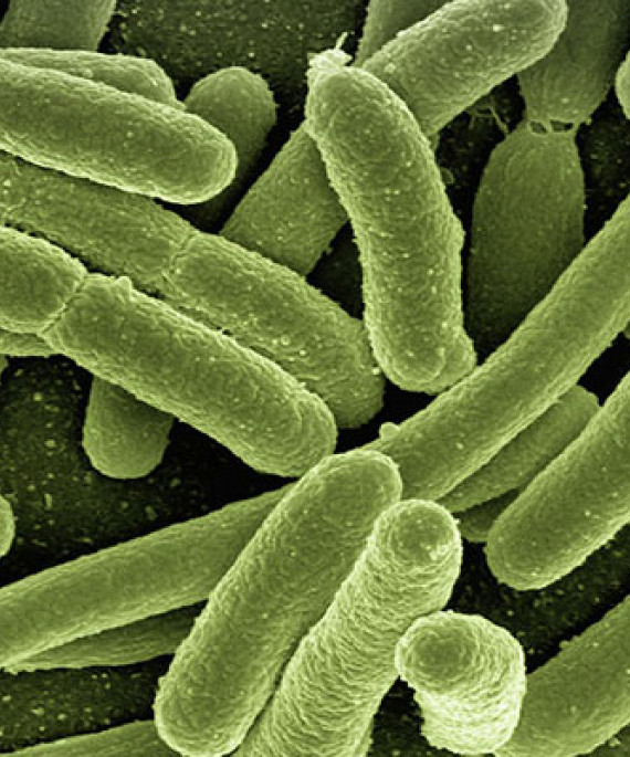 a microscopic view of E. coli bacteria