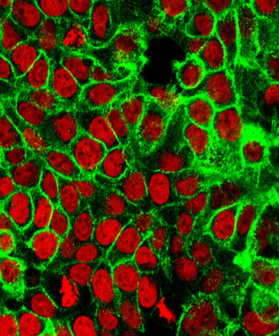 Colon cancer cells
